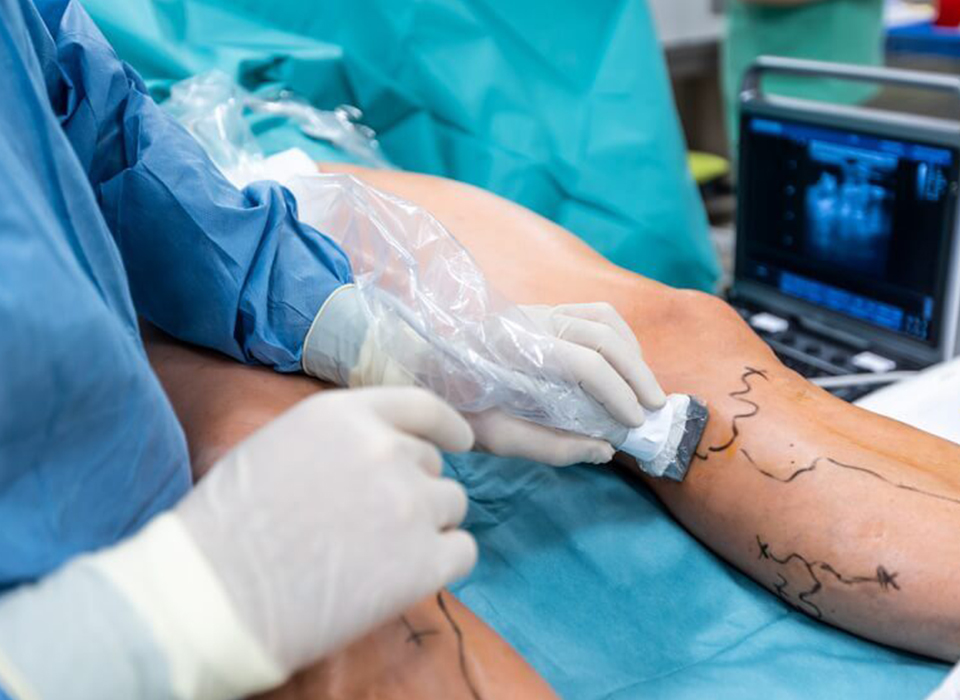 Endovenous-Laser-Treatment-EVLT (1) copy