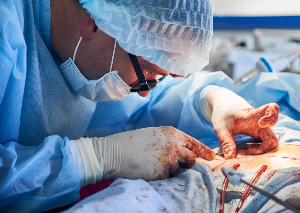 Close up of male surgeon in sterile gloves placing sutures after tummy tuck surgery. Man doctor wearing blue surgical uniform and medical mask, performing abdominal plastic surgery in operating room.